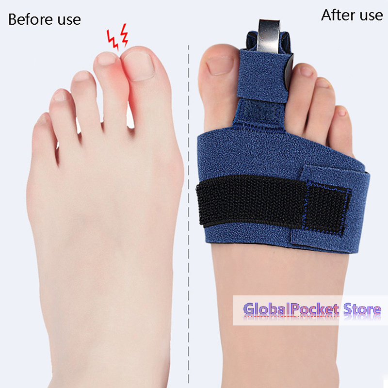 1Pcs Toe Corrector Toe Fractur - Ankle Brace Sock recensione e prezzo